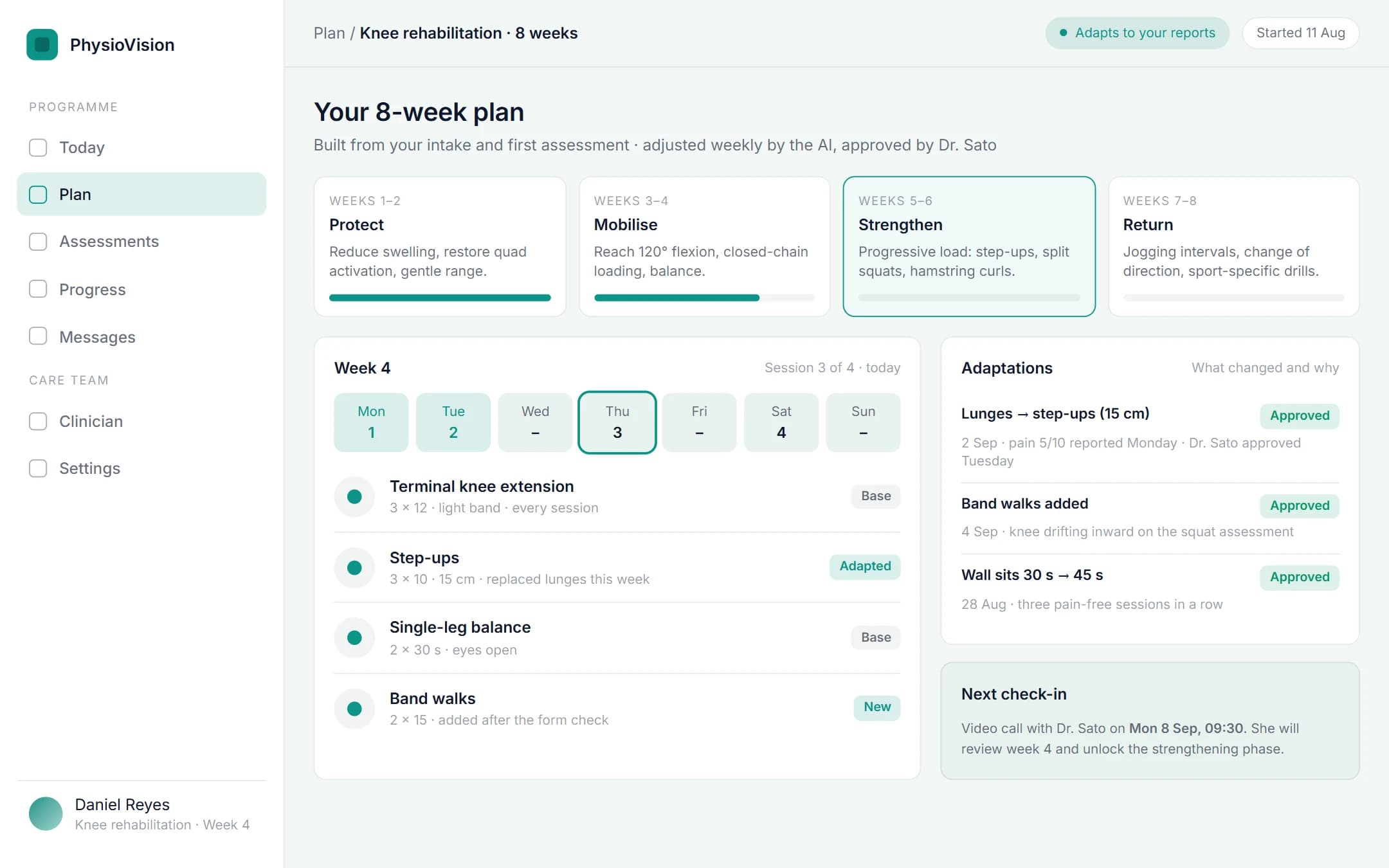 AI Physiotherapy Assistant: Eight-week plan on a laptop